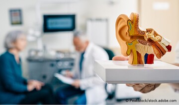 Model-Ohr im Vordergrund: Im Hintergrund bespricht Arzt mit Patientin verschiedene Tinnitus-Arten.